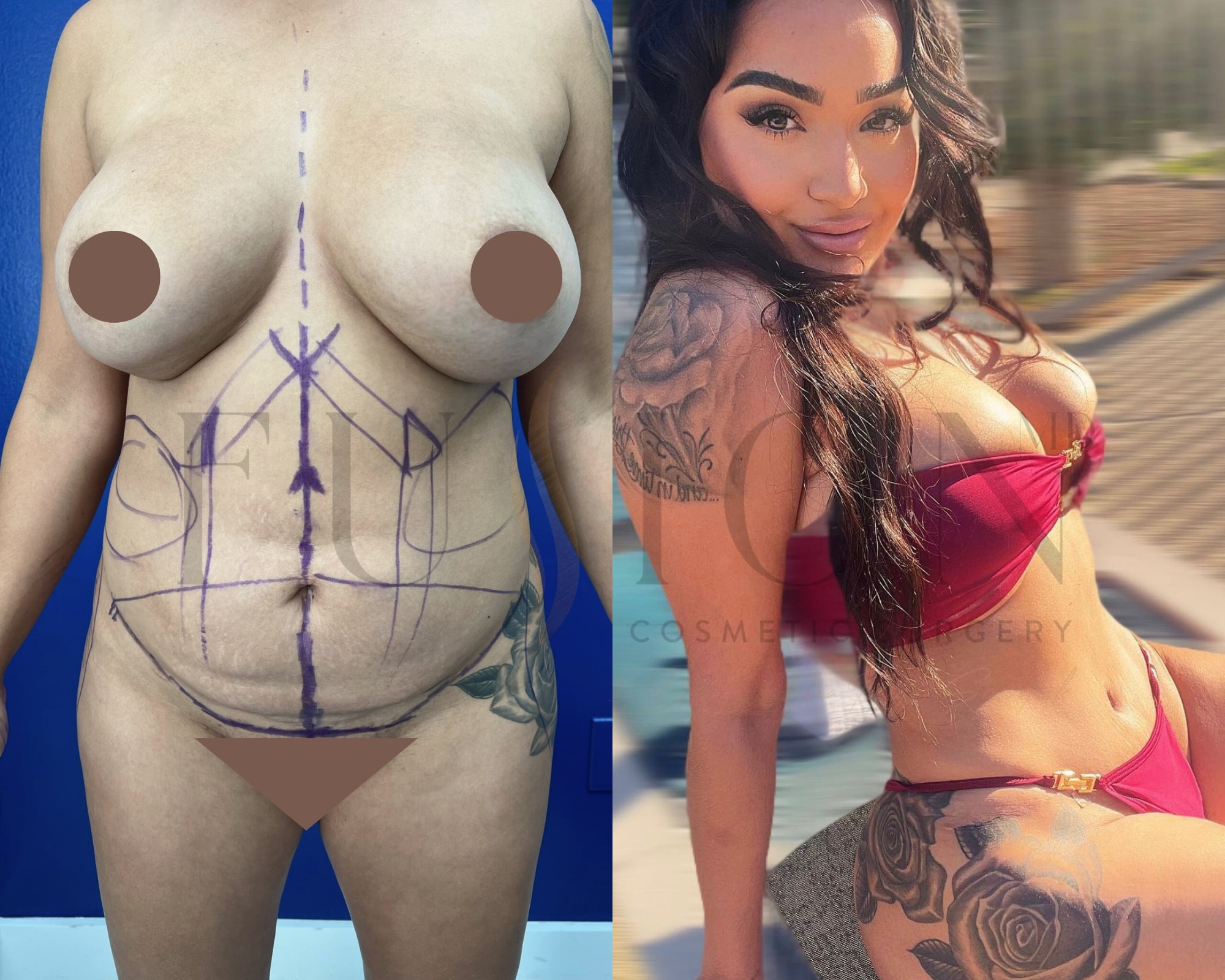 Curvy Tuck Before & After Image