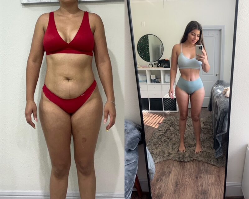curvy tuck Before & After Image