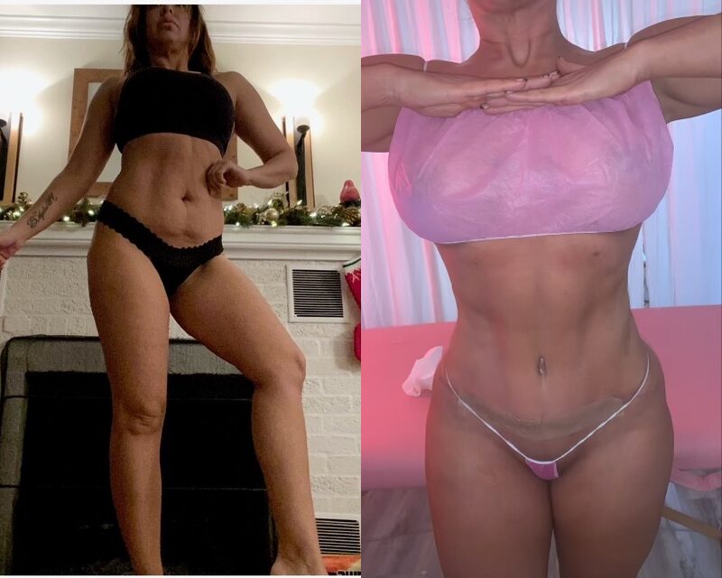 curvy tuck Before & After Image