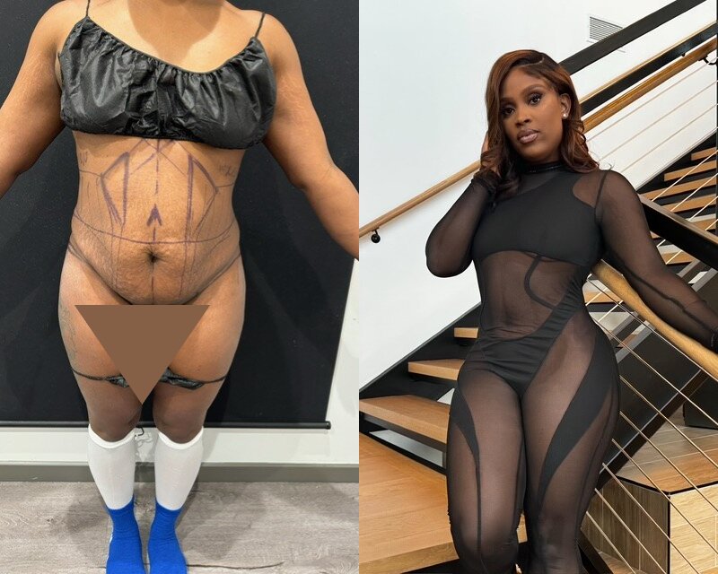 curvy tuck Before & After Image