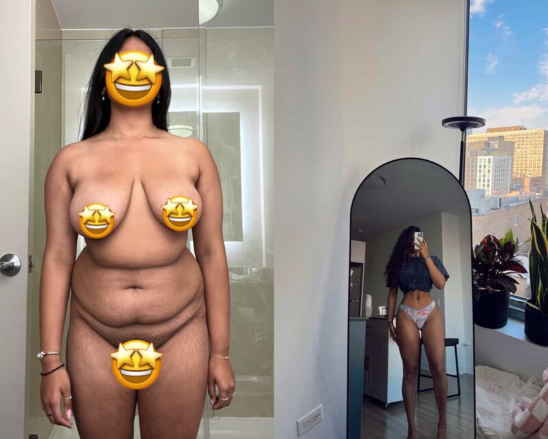 curvy tuck Before & After Image