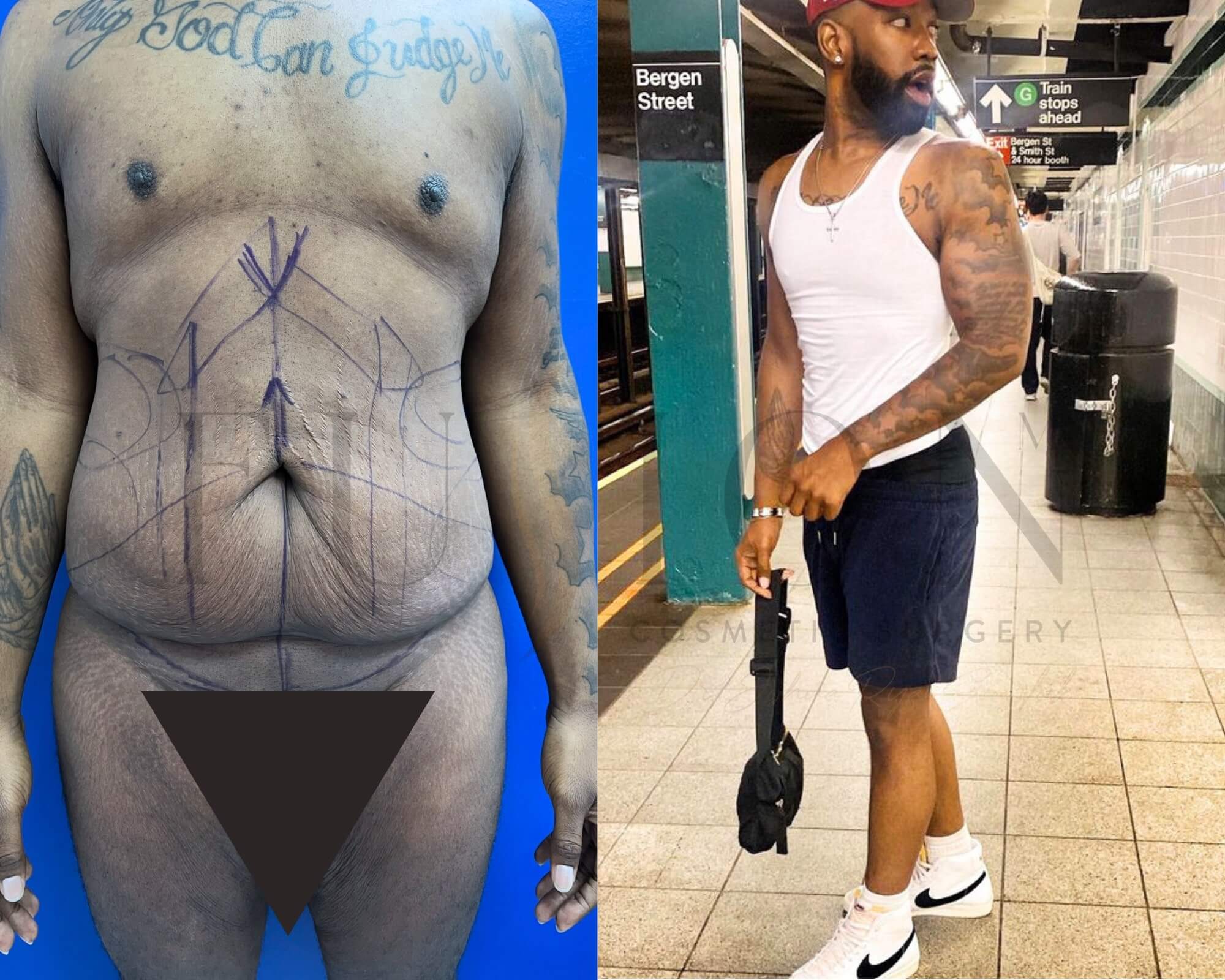 Male Before & After Image