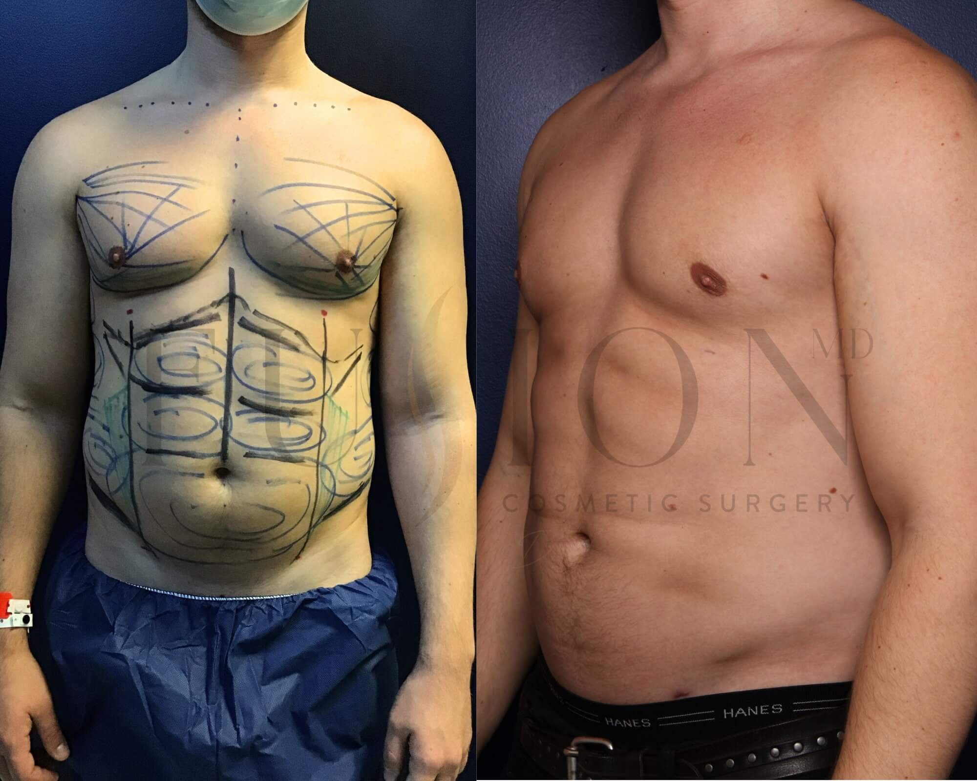 Male Before & After Image