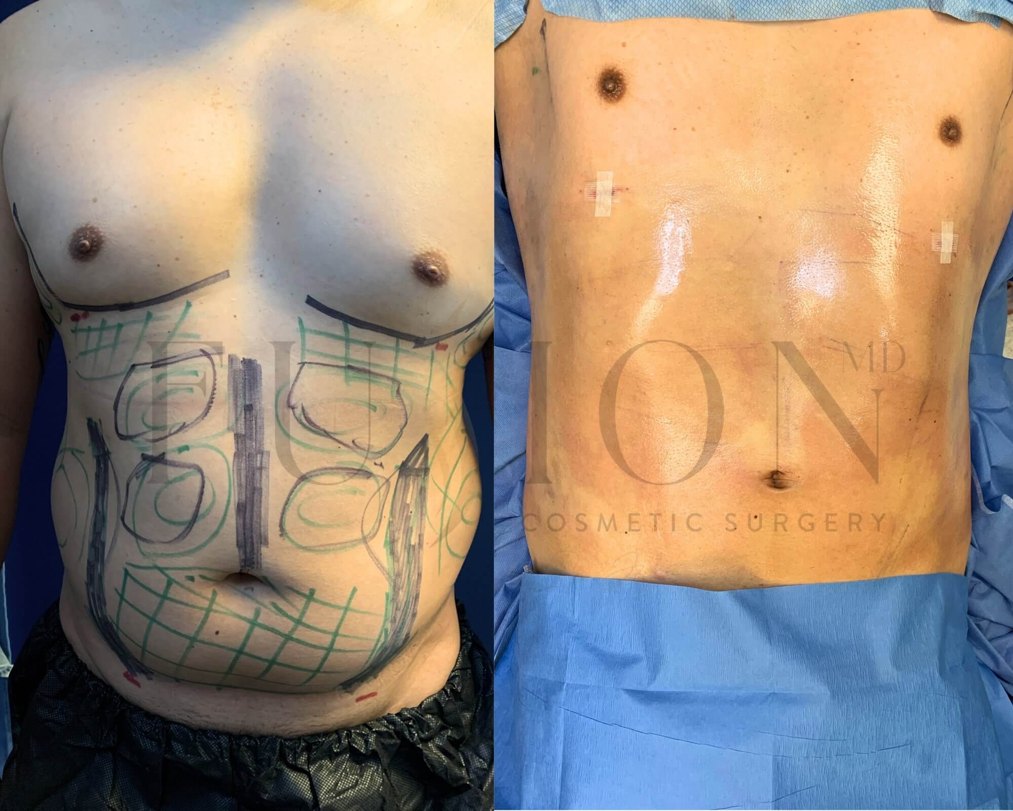 Male Before & After Image