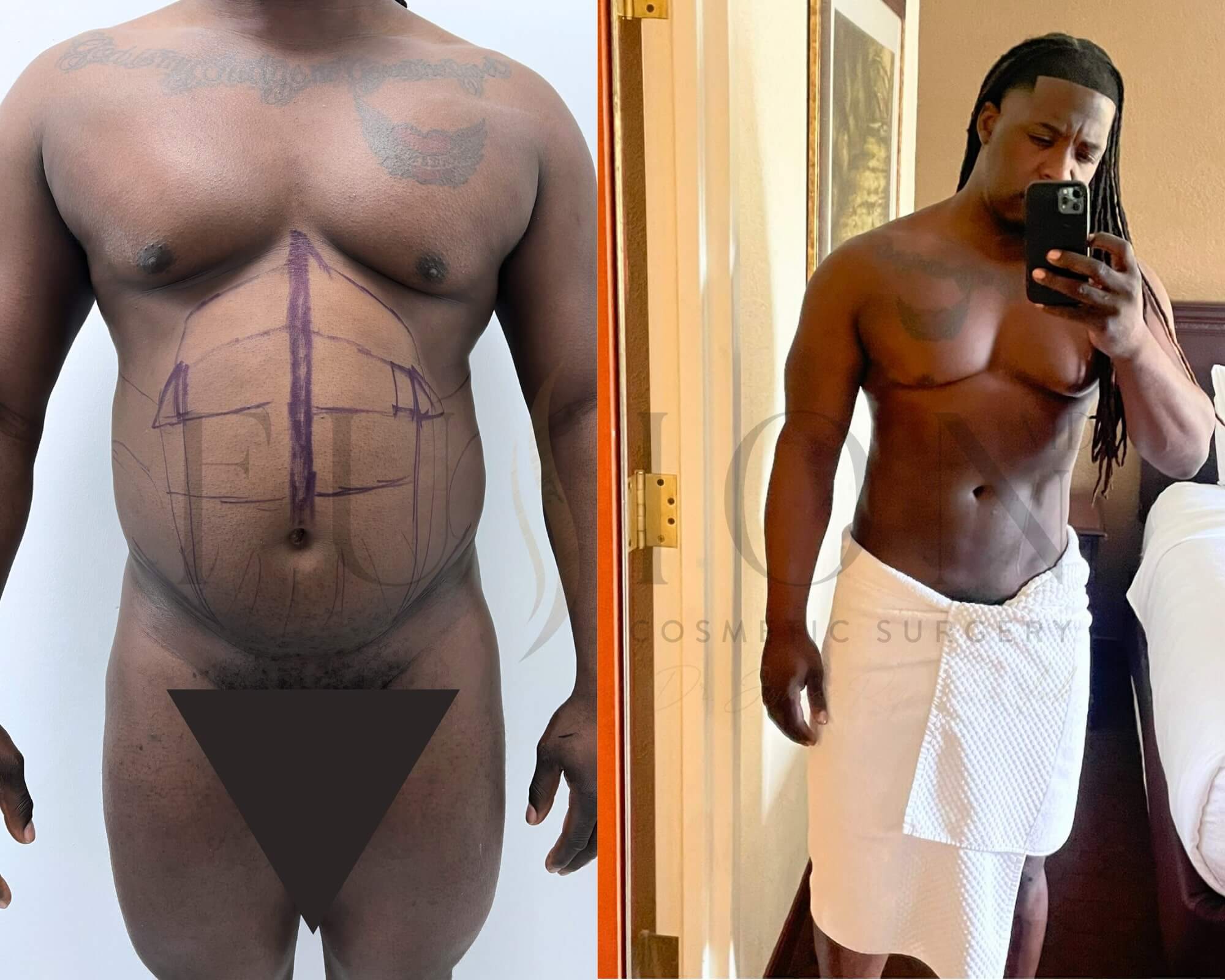 Male Before & After Image