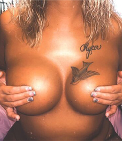 Breast Augmentation Spotlight Patient Spotlight Image