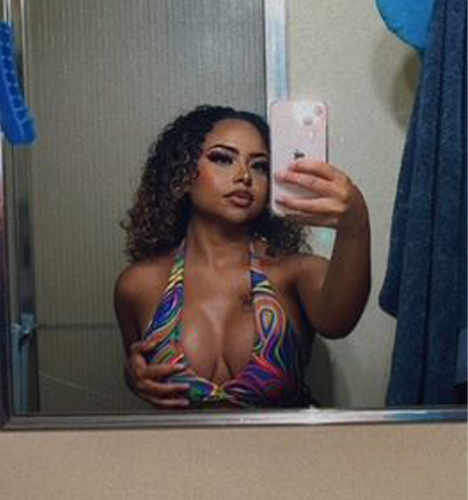 Breast Augmentation Spotlight Patient Spotlight Image