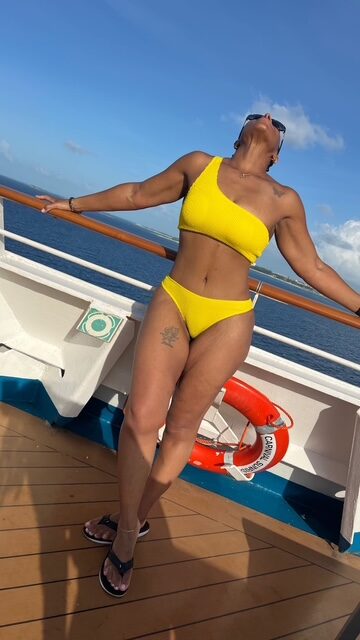 Curvy Tuck Spotlight Patient Spotlight Image