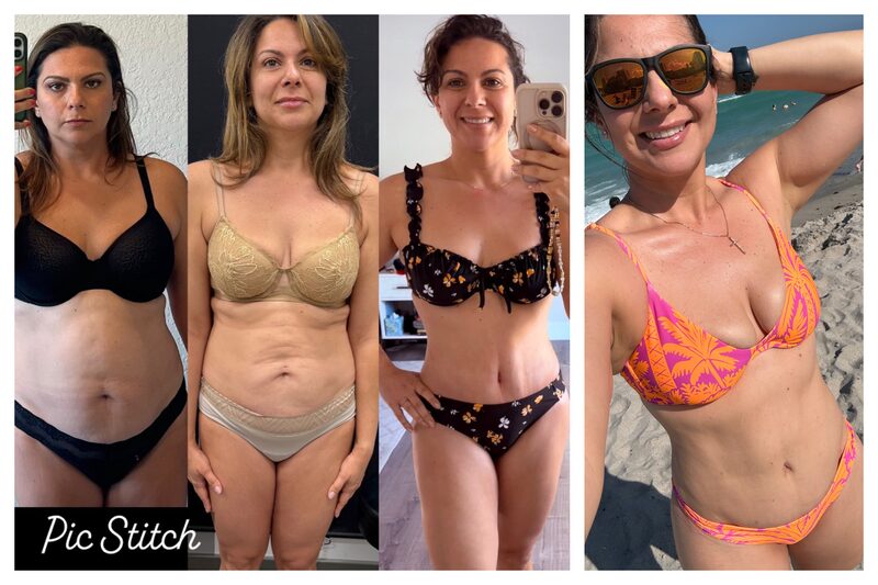 Curvy Tuck Spotlight Patient Spotlight Image